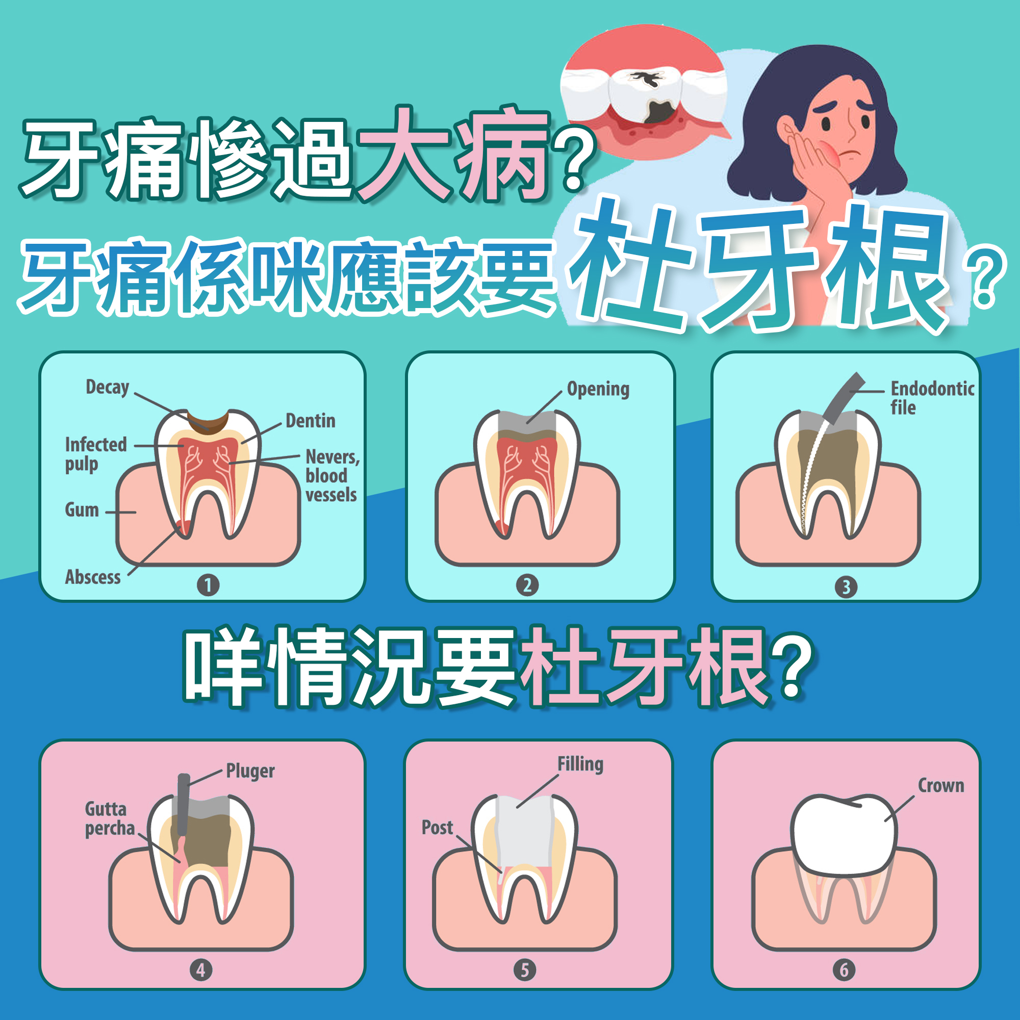 杜牙根情况