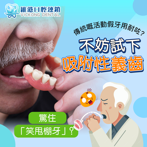 假牙类型