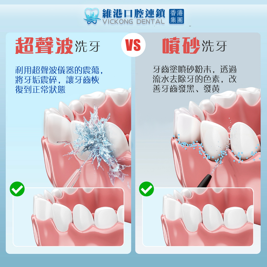 超声波和喷砂洗牙对比