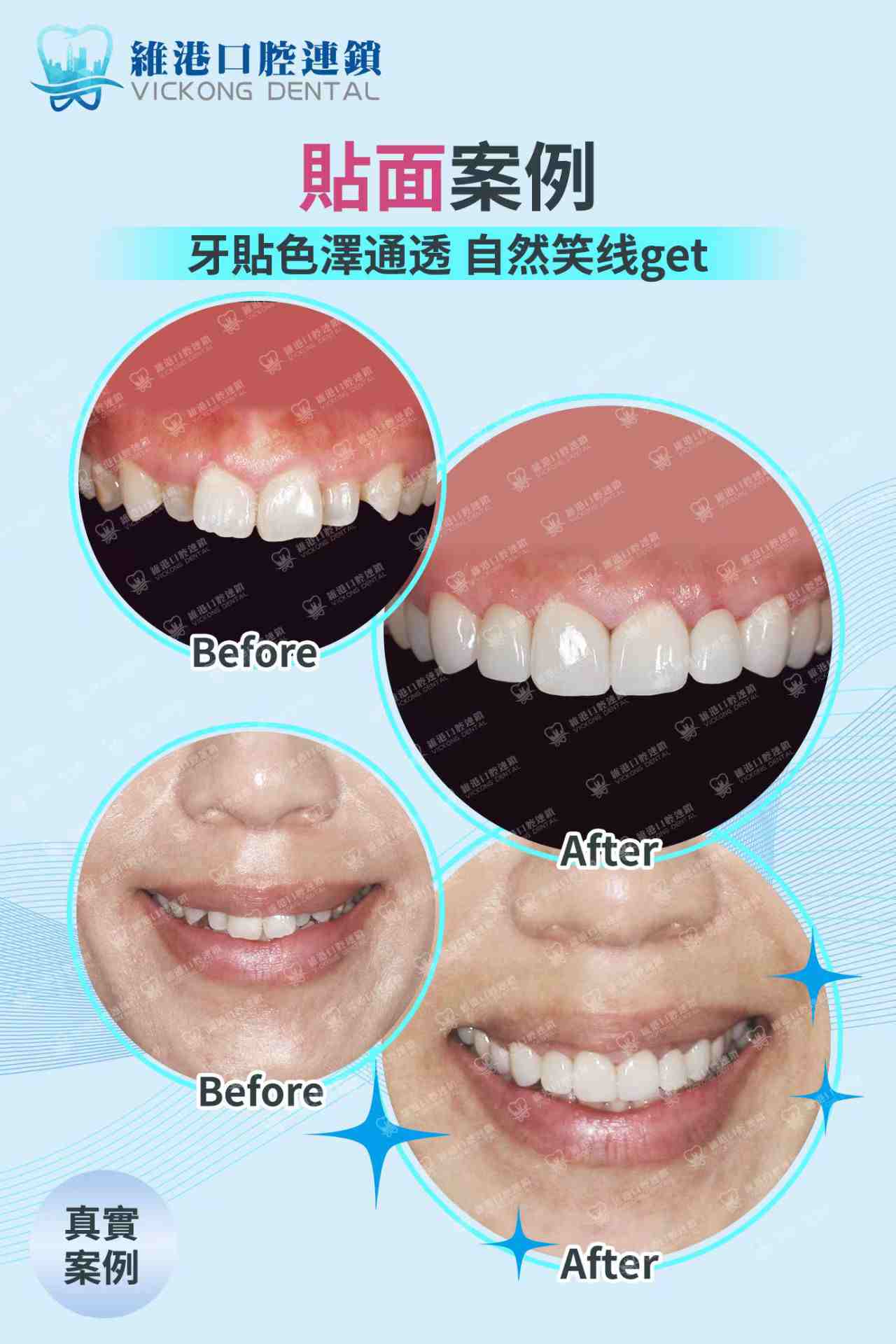 维港口腔