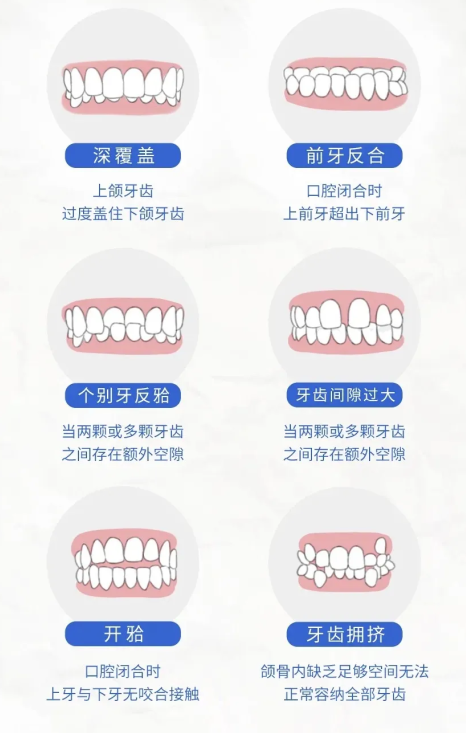 牙齒矯正