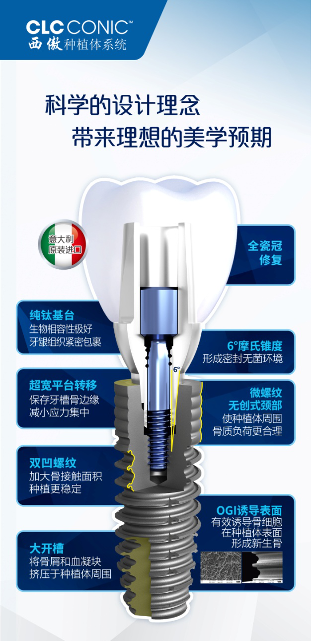 深圳維港歡樂口腔意大利進口種植牙優惠價10800，羅湖口岸種植牙箍牙專科
