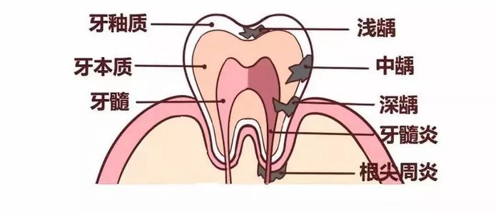 牙齒結構,牙齒構造,牙髓,牙本質,牙釉質