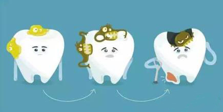 什麼是牙菌斑？有什麼危害？怎樣防止？