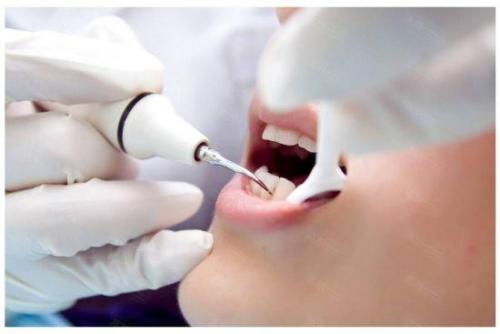 拔複雜牙之前為什麼要拍牙CT呢？拔牙後棉球應該咬多久？