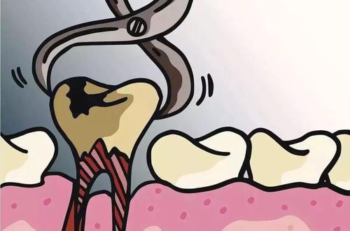 月經期以及急性炎症期為什麼不能拔牙呢？