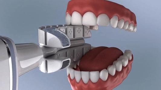 牙齒撞傷後該怎麼辦？