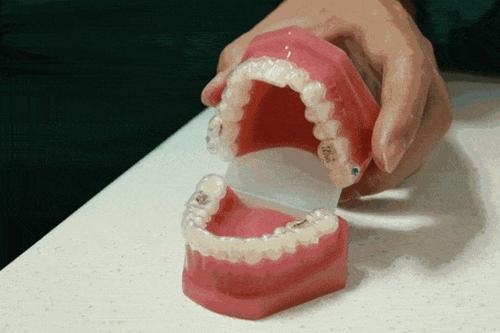 哪些情形需要做牙齒矯正？